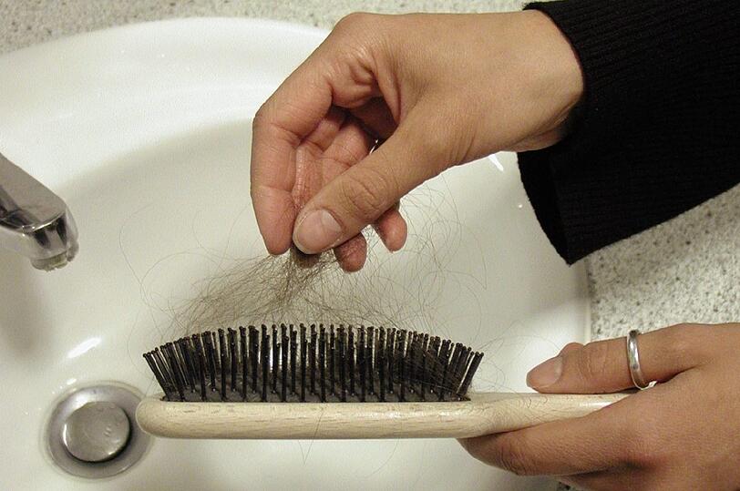 Wenn die Haare dünner werden, kann das Betroffenen auf die Psyche schlagen. (Symbolbild)