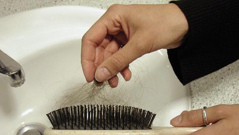 Wenn die Haare dünner werden, kann das Betroffenen auf die Psyche schlagen. (Symbolbild)
