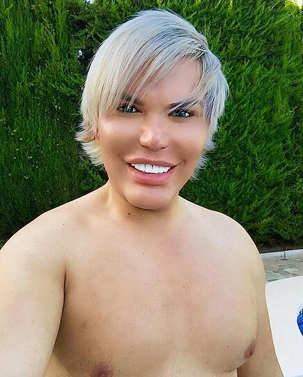 Rodrigo Alves will einer Puppe gleichen