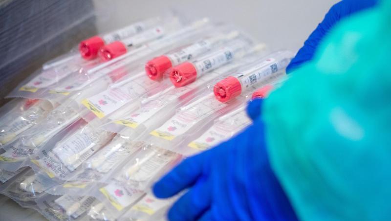 Testsets mit Abstrichstäbchen liegen in einem Testzentrum für Corona-Verdachtsfälle bereit. Testsets mit Abstrichstäbchen liegen in einem Testzentrum für Corona-Verdachtsfälle bereit.