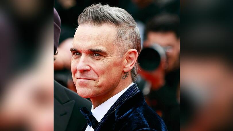 Robbie Williams hat keine Angst vor Schönheitseingriffen.