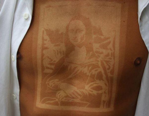 Der #sunburnart-Trend verbreitet sich auf Twitter rasend schnell. Hautärzte warnen vor den Gefahren.