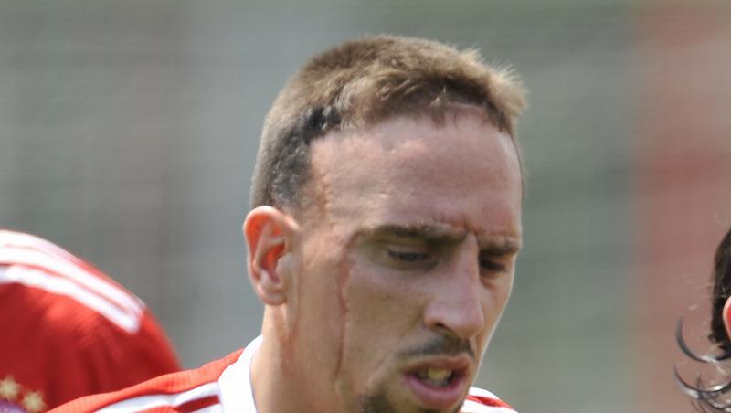 Franck Ribéry: Verletzungssorgen und Wechselgedanken Franck Ribéry: Verletzungssorgen und Wechselgedanken