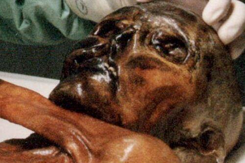 Ötzi