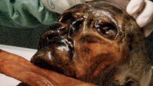 Ötzi Ötzi