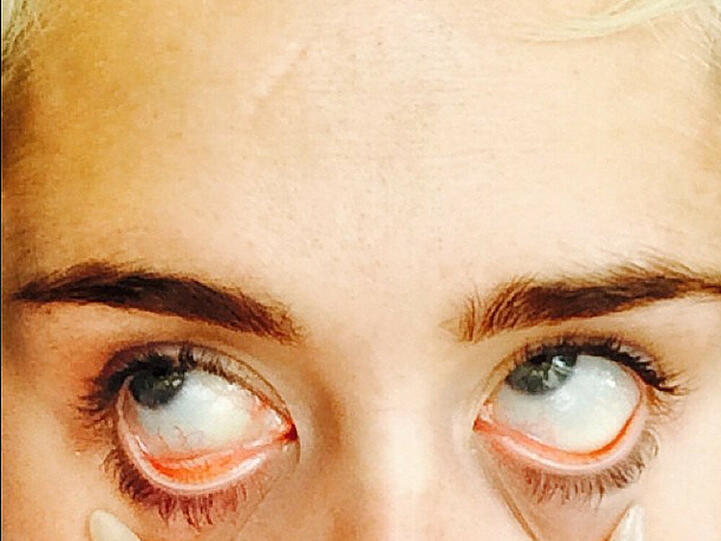 Miley Cyrus ist sich für kein Foto zu schade