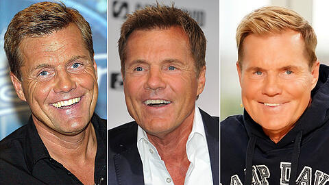 Der Jahresvergleich zeigt: Heute sieht Dieter Bohlen deutlich jünger als vor knapp 20 Jahren aus.