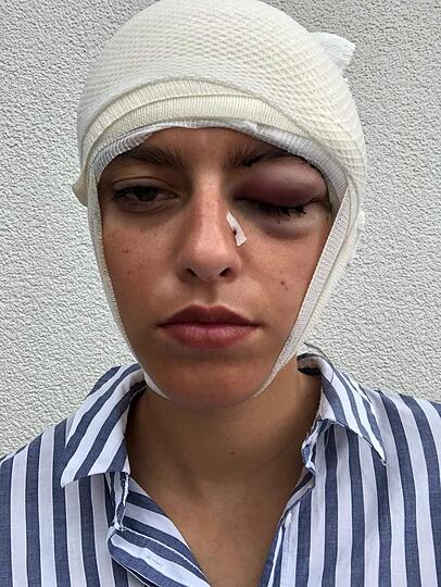 Vanessa Hampl kurz nach dem Vorfall. Vanessa Hampl kurz nach dem Vorfall.