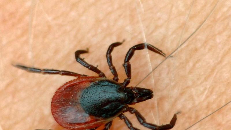 Eine Zecke krabbelt auf der Haut eines Menschen. Foto: Patrick Pleul/dpa/Symbolbild Eine Zecke krabbelt auf der Haut eines Menschen. Foto: Patrick Pleul/dpa/Symbolbild