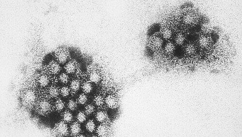 Eine miskroskopische Vergrößerung des Norovirus Eine miskroskopische Vergrößerung des Norovirus