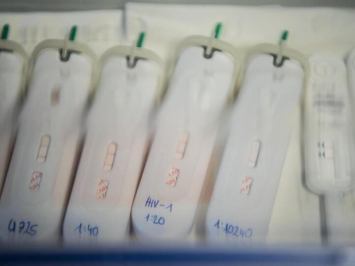 HIV-Schnelltests liegen in einer transparenten Plastikbox. Foto: Andreas Arnoldt