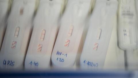 HIV-Schnelltests liegen in einer transparenten Plastikbox. Foto: Andreas Arnoldt