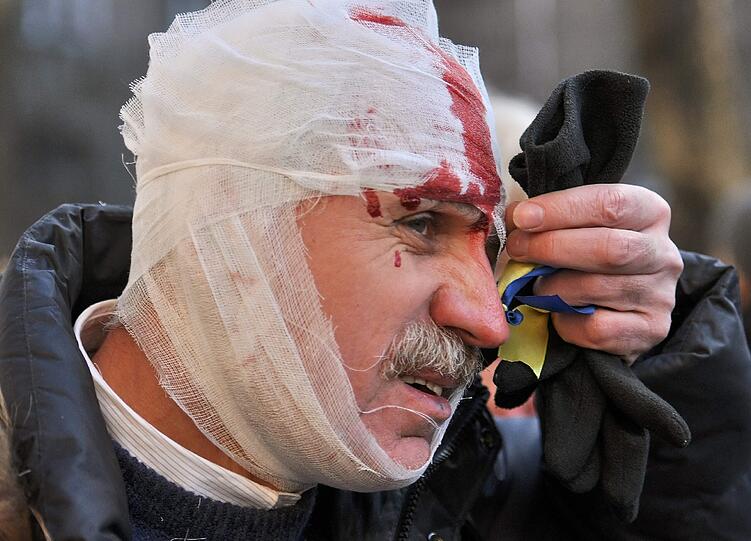 Blut, Feuer, Gewalt: Die Situation in Kiew ist in der Nacht weiter eskaliert. Die Bilder aus der Ukraine.