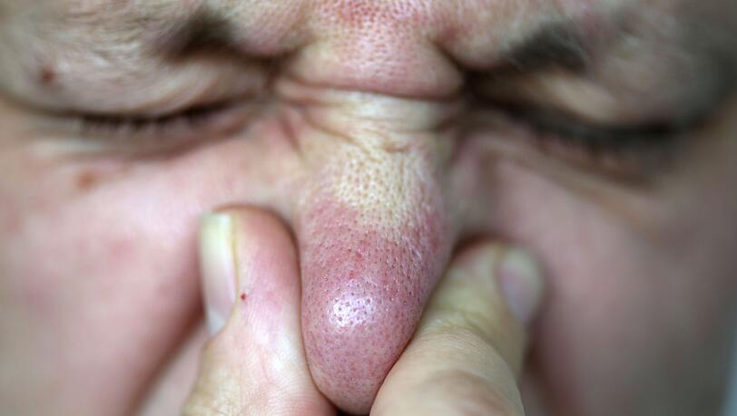 Die Abgasuntersuchung ergab laut dem Landratsamt, dass eine Gesundheitsgef&auml;hrdung nicht besteht. (Symbolbild)