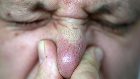 Die Abgasuntersuchung ergab laut dem Landratsamt, dass eine Gesundheitsgefährdung nicht besteht. (Symbolbild)