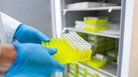 Ehec steht für enterohämorrhagische Escherichia coli und bezeichnet bestimmte krankmachende Stämme dieses im Darm vorkommenden Bakteriums.