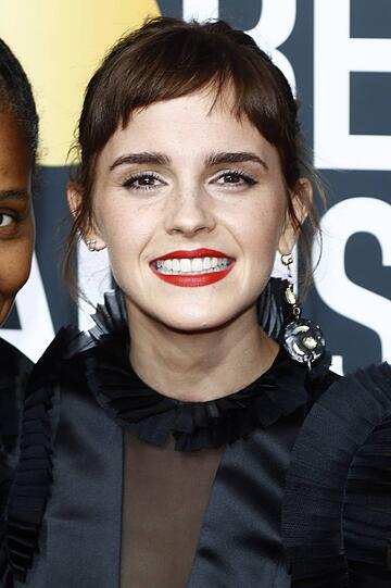 Heute hat Emma Watson die wohl perfekteste Zahnreihe Hollywoods.
