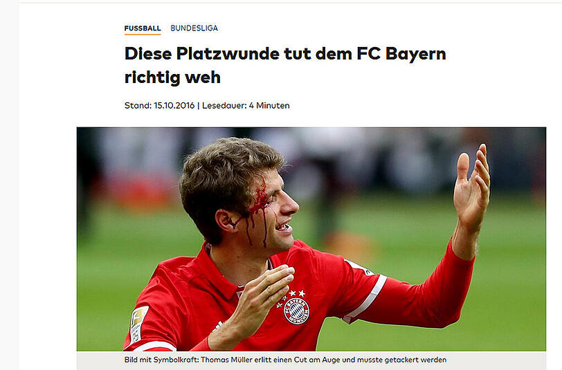 Die Platzwunde von Thomas Müller dient als Metapher bei "welt.de"...
