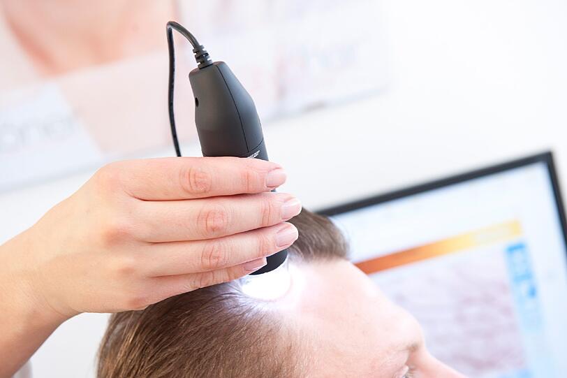 Dann kann es losgehen mit der modernen Low-Level-Laser-Therapie von Savehair.