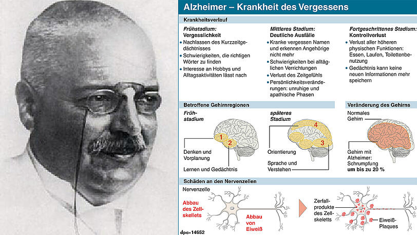Alois Alzheimer entdeckte die Krankheit des Vergessens.