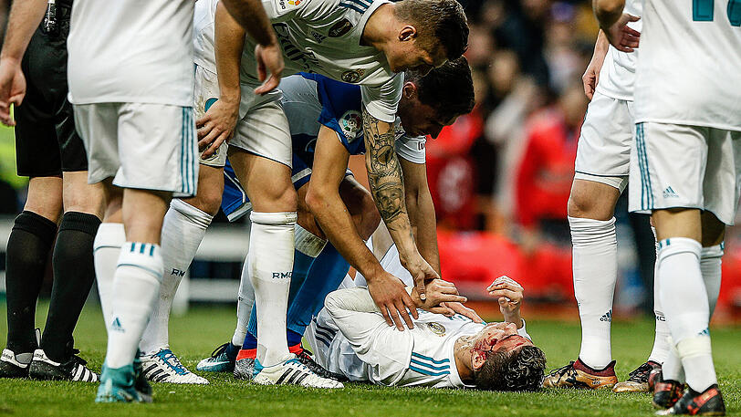 Cristiano Ronaldo erlitt einen Cut im Gesicht.