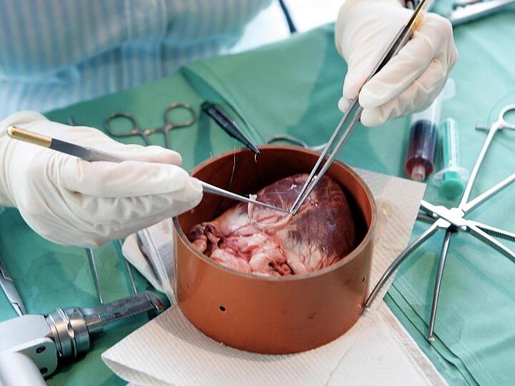 Mit mikrochirurgischen Instrumenten wird an einem Schweineherz in der Uniklinik in Frankfurt am Main operiert.