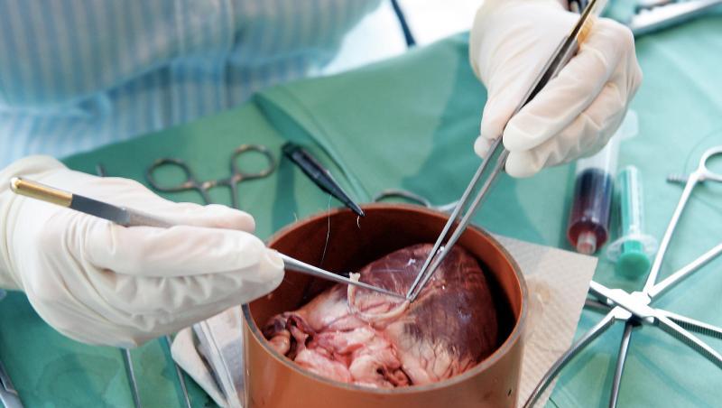 Mit mikrochirurgischen Instrumenten wird an einem Schweineherz in der Uniklinik in Frankfurt am Main operiert. Mit mikrochirurgischen Instrumenten wird an einem Schweineherz in der Uniklinik in Frankfurt am Main operiert.