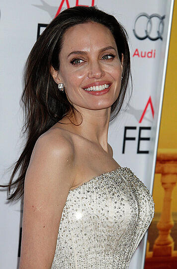 Angelina Jolie: Die Schauspielerin litt unter Schwangerschafts-Diabetes. Diese Form der Zuckerkrankheit entsteht während der Schwangerschaft und verschwindet in der Regel wieder nach der Geburt des Kindes. Übergewicht, ein Alter über 30 Jahre sowie Vorbelastungen in der Familie zählen als Risikofaktoren. Meistens bekommt man Schwangerschafts-Diabetes durch eine Ernährungsumstellung und mehr Bewegung in den Griff.