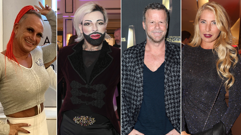 Viele Promis haben bei ihrem Aussehen nachhelfen lassen. Diese Stars stehen offen dazu, dass sie bereits beim Beauty-Doc waren.