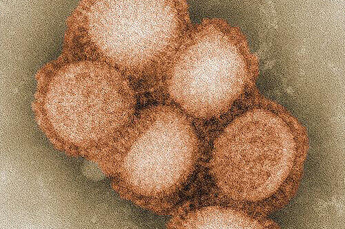 Der fiese Influenza-Erreger.