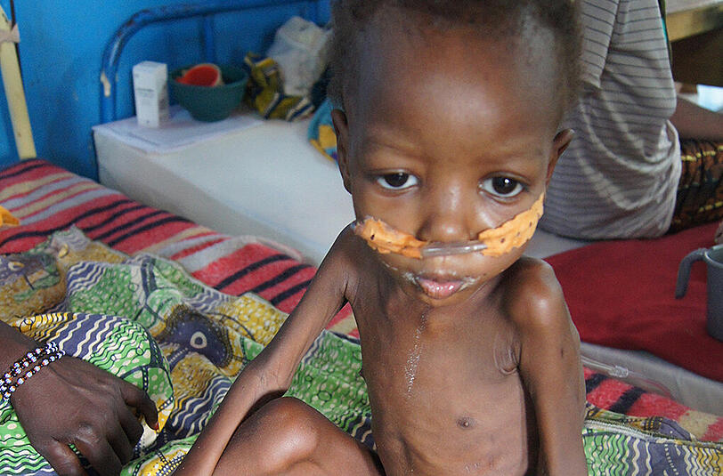 In afrikanischen Dürrezeiten leiden vor allem die Kinder. Ärzte und Hilfsorganisationen versuchen, den kleinen Patienten mit therapeutischer Zusatznahrung zu helfen.