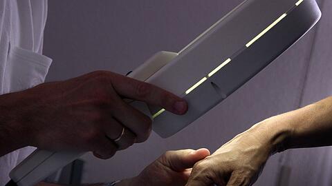 Auch pr&auml;ventive Untersuchungen auf Hautkrebs k&ouml;nnen Todesf&auml;lle verhindern. (Symbolbild)