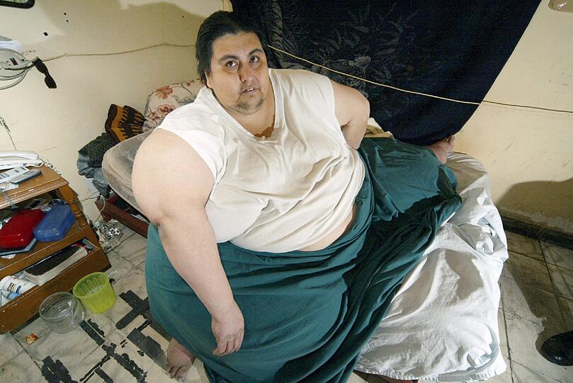 Manuel Uribe hatte in den letzten Jahren über 200 Kilo abgespeckt. Am Montag kam der fettleibige Mexikaner mit Herzproblemen ins Krankenhaus, wo der schließlich verstarb.