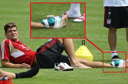 Neue Bilder vom Trainingslager der Bayern am Gardasee: Mario Gomez hat's am Sprunggelenk erwischt. Der Stürmer braucht einen Eisbeutel...