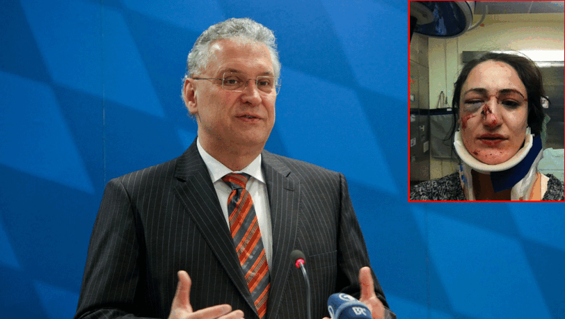 Bayerns Innenminister Joachim Herrmann zieht Konsequenzen aus den Prügelvorwürfen gegen einen Münchner Polizisten. Bayerns Innenminister Joachim Herrmann zieht Konsequenzen aus den Prügelvorwürfen gegen einen Münchner Polizisten.
