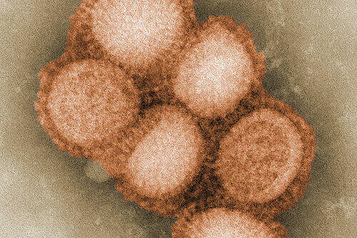 Greift weiter um sich: der gefährliche Schweinegrippe-Virus.