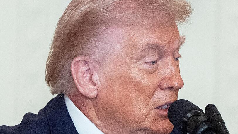 Eine Stelle an Trumps Hals hat eine Welle von Spekulationen &uuml;ber die Gesundheit des Pr&auml;sidenten ausgel&ouml;st.