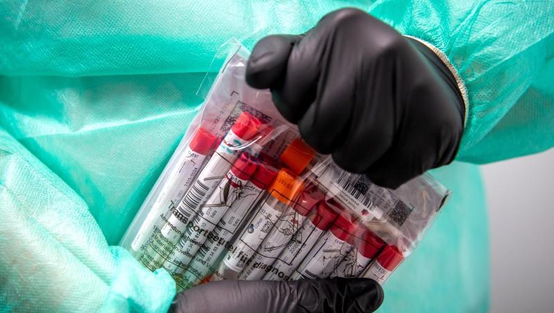 Proben für einen PCR-Test werden von einem Mitarbeiter im Corona-Testzentrum verpackt. (Archivbild).