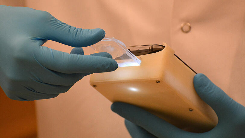Das undatierte Foto zeigt ein Techniker, der den Fruchtbarkeitstest durchführt. Es besteht aus einem optischen Zubehörteil, auf dem das Smartphone befestigt wird. Die Qualität von Sperma könnte sich auf günstige und unkomplizierte Weise mit Hilfe eines Smartphones beurteilen lassen. US-Forscher stellen ein solches Sperma-Check-System für die Heimanwendung im Fachblatt "Science Translational Medicine" vor. Das undatierte Foto zeigt ein Techniker, der den Fruchtbarkeitstest durchführt. Es besteht aus einem optischen Zubehörteil, auf dem das Smartphone befestigt wird. Die Qualität von Sperma könnte sich auf günstige und unkomplizierte Weise mit Hilfe eines Smartphones beurteilen lassen. US-Forscher stellen ein solches Sperma-Check-System für die Heimanwendung im Fachblatt "Science Translational Medicine" vor.