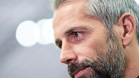 Gladbachs Trainer Marco Rose muss seine Devensive neu aufstellen.