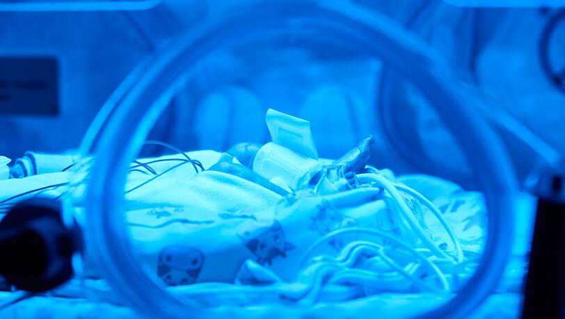 Zwei Jahre wird das Projekt in N&uuml;rnberg getestet, dann k&ouml;nnte die KI bayernweit eingesetzt werden. (Symbolbild)