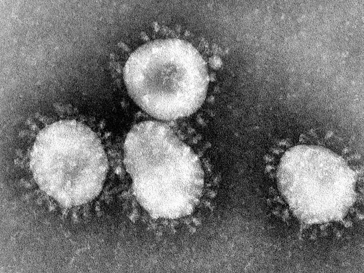 Eine Mikroskopaufnahme zeigt das Coronavirus. Foto: Center for Disease Control/epa/dpa/Archivbild