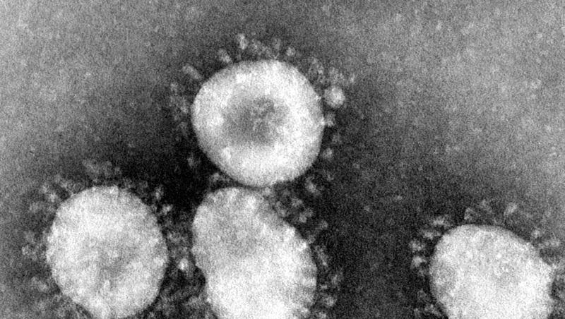 Eine Mikroskopaufnahme zeigt das Coronavirus. Foto: Center for Disease Control/epa/dpa/Archivbild Eine Mikroskopaufnahme zeigt das Coronavirus. Foto: Center for Disease Control/epa/dpa/Archivbild