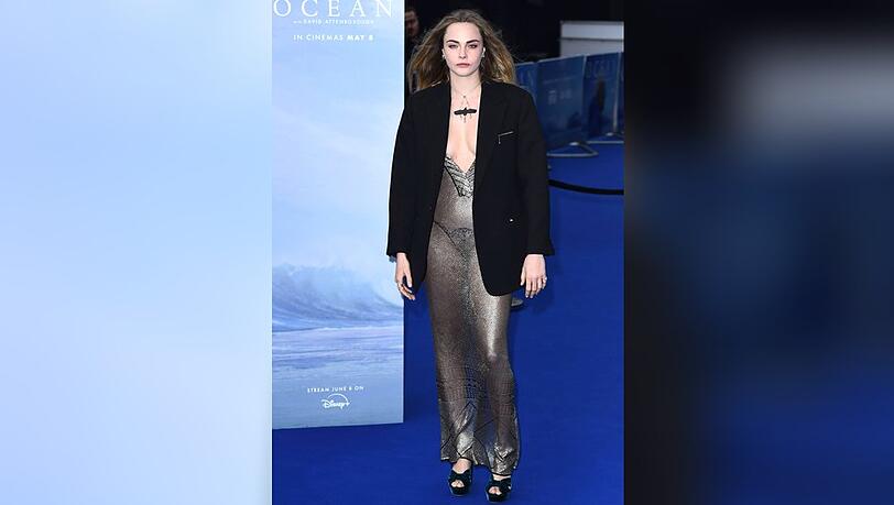 Cara Delevingne setzt auf Transparenz.