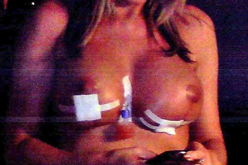 Wurde vom inzwischen entlassenen Arzt behandelt: Die Münchnerin Martina H. nach ihrer Brust-OP