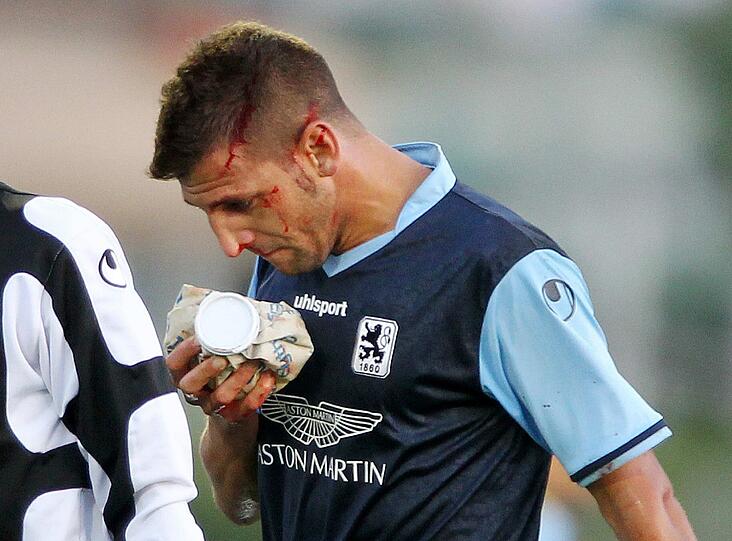 Beim 0:0 im Test gegen Austria muss Guillermo Vallori mit viel Blut am Kopf vom Feld. Die Löwen-Fans befürchten schnell schlimmstes &ndash; Trainer Maurer aber bleibt gelassen. Sehen Sie hier die Bilder.