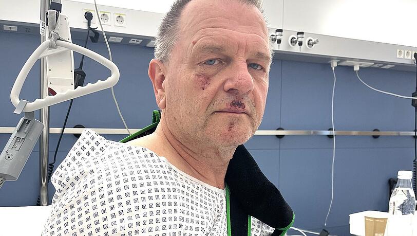 Der von einem E-Scooter umgefahrene Christian Schulz lag noch übers Wochenende im Krankenhaus und musste mehrfach operiert werden. Seine rechte Schulter ist mehrfach gebrochen. Der von einem E-Scooter umgefahrene Christian Schulz lag noch übers Wochenende im Krankenhaus und musste mehrfach operiert werden. Seine rechte Schulter ist mehrfach gebrochen.
