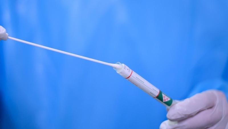 Ein Arzt hält einen Coronavirus-Test in den Händen.