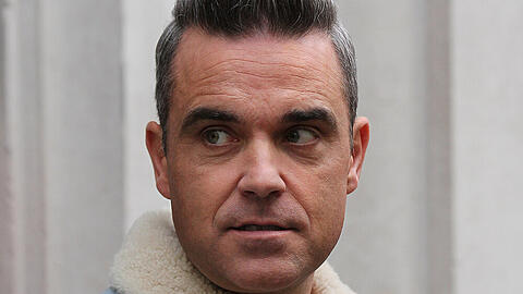 So viele Haare hat Robbie Williams derzeit nicht mehr auf dem Kopf.