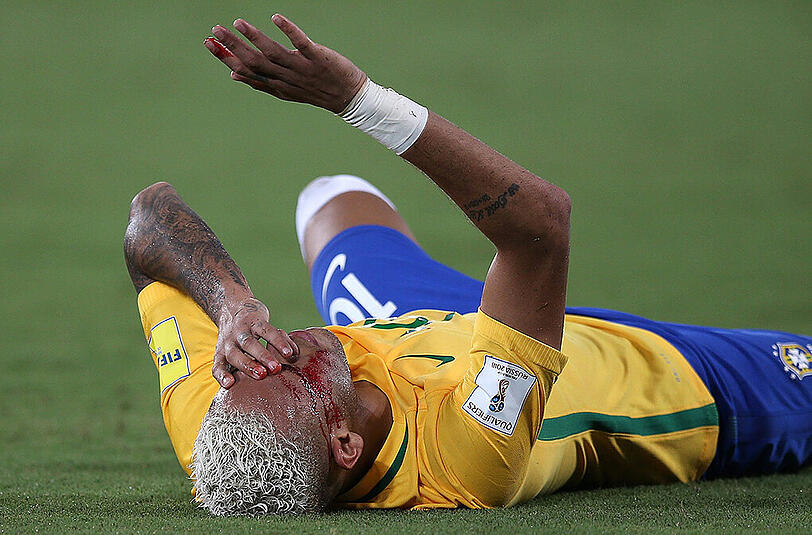 Die Neymar-Show beim 5:0 (4:0) im WM-Qualifikationsspiel gegen Bolivien fand nach einem Ellbogen-Stoß ihr spektakuläres, blutiges Schlussbild.